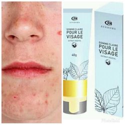Gomme claire visage