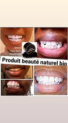 Blanchiment dentaire naturel