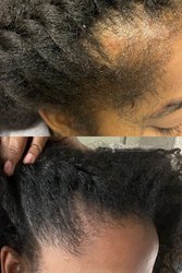 Soins capillaires à domicile 