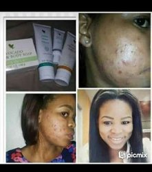 Produits à base aloe vera