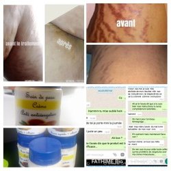 Produit anti-vergetures